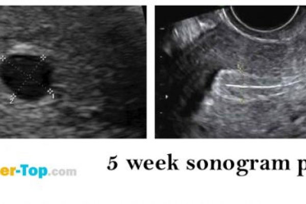 Кракен картель